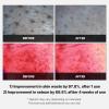 imagemedicube Turmeric Clarifying Toner Pad for Troubled Skin ampamp Use After Spot Care  Soothing ampamp Calming with Turmeric Niacinamide Glycolic Acid  Korean Skin Care 70 PadsRed Succinic Acid Peeling Pads