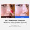 imagemedicube daily toner pads tailored to skin condition Zero Pore Pads 20 2ea and Zero Pore Pads Mild 20 1ea
