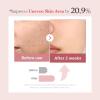 imagemedicube Azelaic Acid Exosome Shot Serum 7500  Deep Hydration for Smooth Even Skin Texture  Use for After Spot Care with Azelaic Acid Niacinamide  Korean Skincare 30ml  101 flozPDRN 7 500
