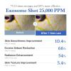 imagemedicube Azelaic Acid Exosome Shot Serum 7500  Deep Hydration for Smooth Even Skin Texture  Use for After Spot Care with Azelaic Acid Niacinamide  Korean Skincare 30ml  101 flozZero 25 000