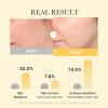 imagemedicube Day ampamp Night Kojic Acid Duo Kojic Acid Turmeric Brightening Gold Jelly Gel Mask and Kojic Acid Turmeric Clarifying Toner Pad
