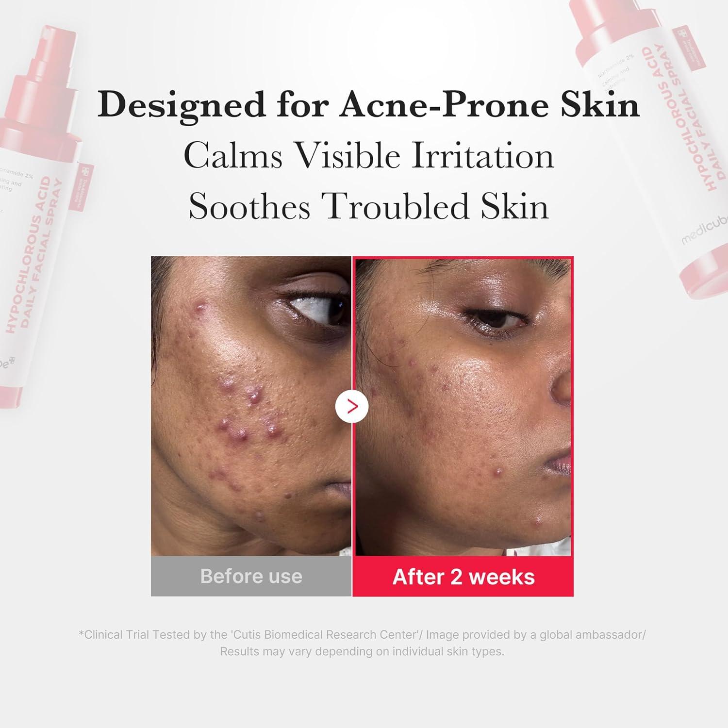 imagemedicube Power Soothing Spray  Hypochlorous Acid Spray For All Skin Types Delicate Skin  Daily Skin Solution ampamp PostSun Care  HOCI Facial Mist for Soothing ampamp Calming  Korean Skincare  169 floz