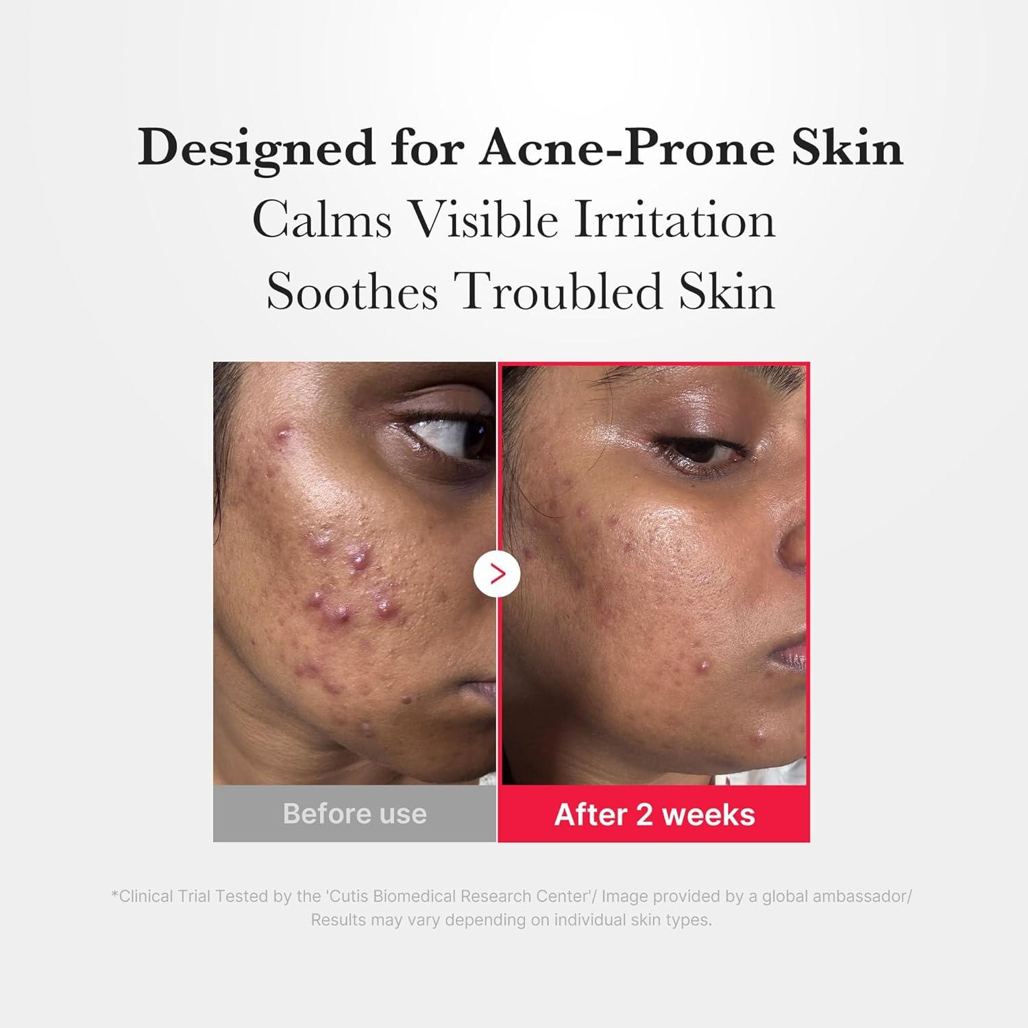 imagemedicube Power Soothing Spray  Hypochlorous Acid Spray For All Skin Types Delicate Skin  Daily Skin Solution ampamp PostSun Care  HOCI Facial Mist for Soothing ampamp Calming  Korean Skincare  422 floz