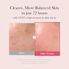 imagemedicube Ultimate Clear Glass Skin Serum Duo TXA  Niacinamide 15 Glow Facial Serum and PDRN Pink Peptide Serum for Uneven Skin Tone and Texture  Korean Skincare
