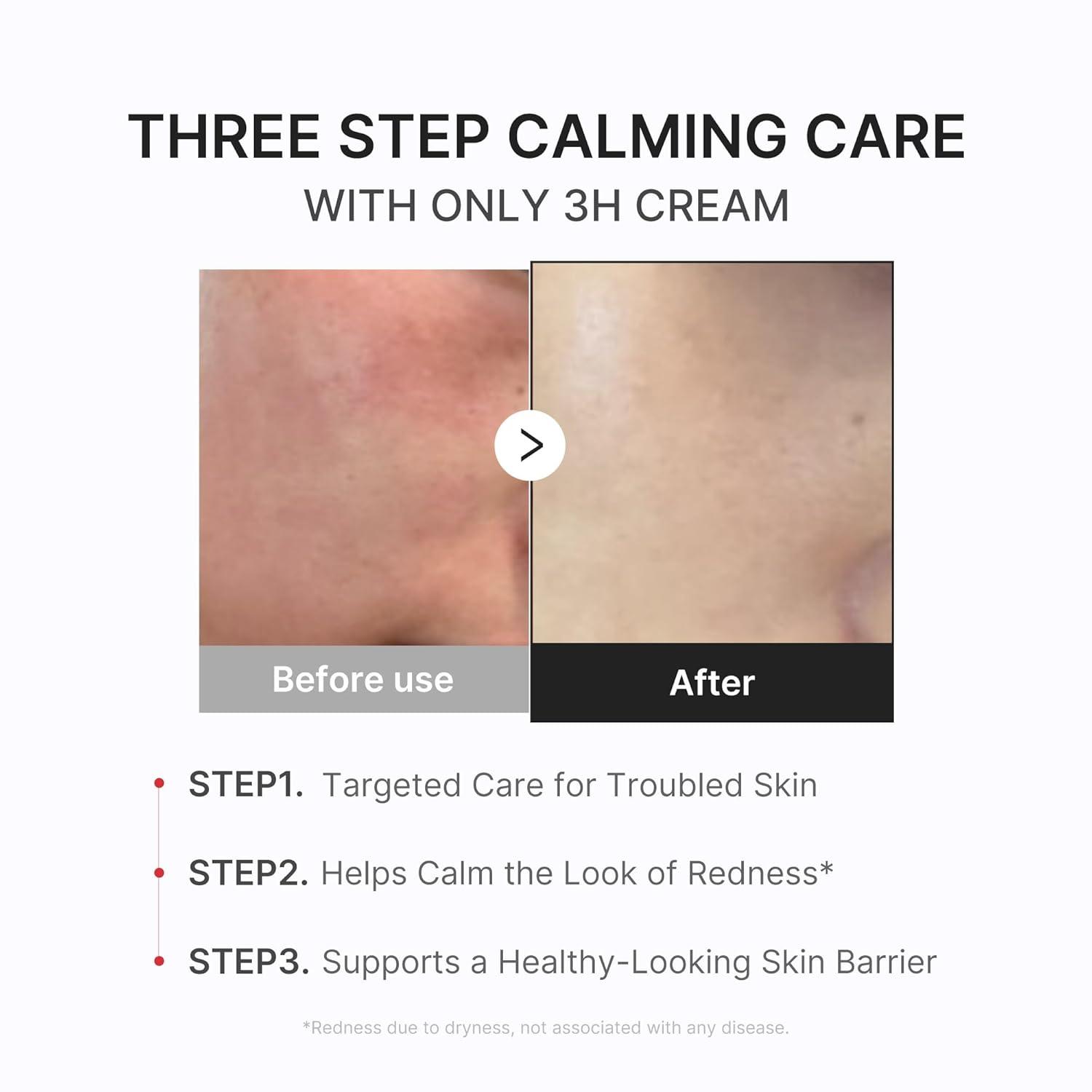 imagemedicube 3H Daily Relief Cream  Daily Soothing Moisturizer for All Skin Types  Lightweight Comforting Cream Ideal For Use After Spot Care  Guaiazulene Centella Ceramide for Balance and Hydration