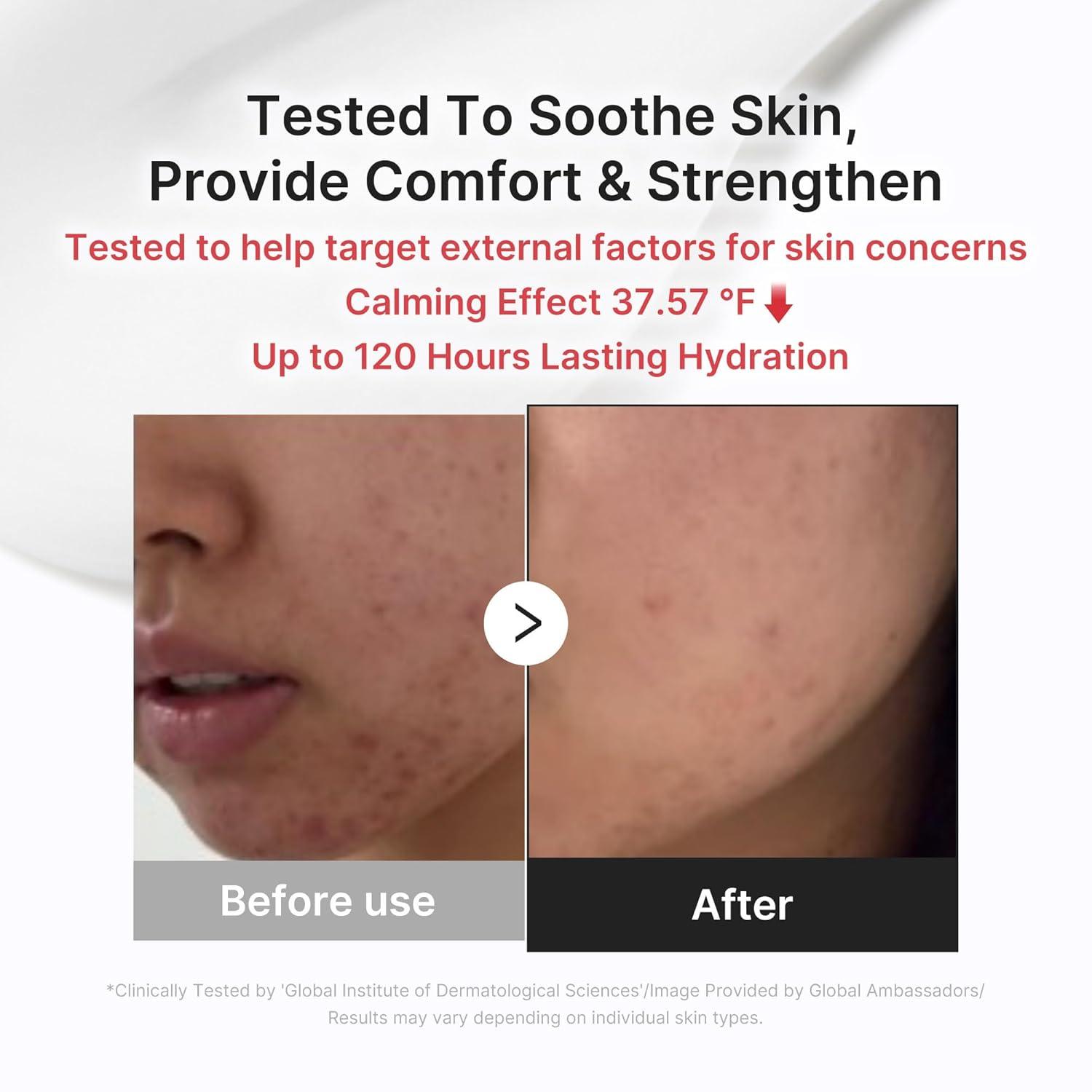imagemedicube 3H Daily Relief Cream  Daily Soothing Moisturizer for All Skin Types  Lightweight Comforting Cream Ideal For Use After Spot Care  Guaiazulene Centella Ceramide for Balance and Hydration