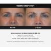 imageMedicube AgeR USSERA Facial Treatment Device  atHome Skin Care Device for Collagen Stimulation Wrinkle Reduction and Youthful Complexion  Korean Skin Care
