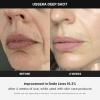 imageMedicube AgeR USSERA Facial Treatment Device  atHome Skin Care Device for Collagen Stimulation Wrinkle Reduction and Youthful Complexion  Korean Skin Care