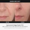 imageMedicube AgeR USSERA Facial Treatment Device  atHome Skin Care Device for Collagen Stimulation Wrinkle Reduction and Youthful Complexion  Korean Skin Care