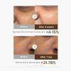 imagemedicube Deep Vita C Capsule Serum amp Cream Duo Liposome Vita C Capsule Serum and Vita C Capsule Cream  Hydrating Vitamin C Capusle for Dull UnevenLooking Skin