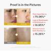 imagemedicube Kojic Acid Turmeric Peel amp Tone Facial Duo Turmeric Peel Shot and Kojic Acid Smoothing Toner  Gentle Facial Exfoliation amp ToneRefining Care for Uneven Skin Tone amp Texture