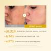 imagemedicube Kojic Acid Turmeric Peel amp Tone Facial Duo Turmeric Peel Shot and Kojic Acid Smoothing Toner  Gentle Facial Exfoliation amp ToneRefining Care for Uneven Skin Tone amp Texture