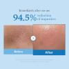 imagemedicube Korean HomeSpa Pore Care Routine Zero Pore Blackhead Mud Facial Mask and Zero Pore Blackhead Cleansing Oil