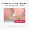 imagemedicube Mini Booster Pro Plus Cleansing Device Set  2in1 Facial Cleansing Skincare Device  Pore Makeup Excess Sebum Care  Portable Skincare Booster with 3 Modes  Korean Facial Device PinkBeige