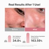 image:imagemedicube PDRN Pink Vita Coating Mask 10eaPink